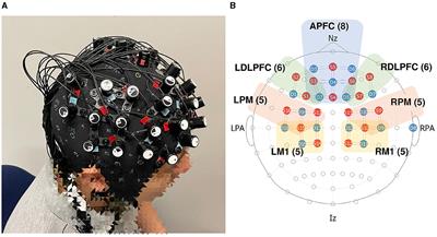 Neural dynamics of delayed feedback in robot teleoperation: insights from fNIRS analysis